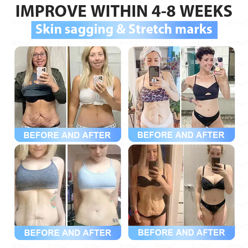 BuildLeaf® is selling fast — almost gone! Enjoy 50% OFF for the next 15 minutes only! 🚚 Free upgrade to priority air shipping ✨ Long-lasting results for arms, neck, chest & more ✔️ Still covered by our 180-day refund policy.