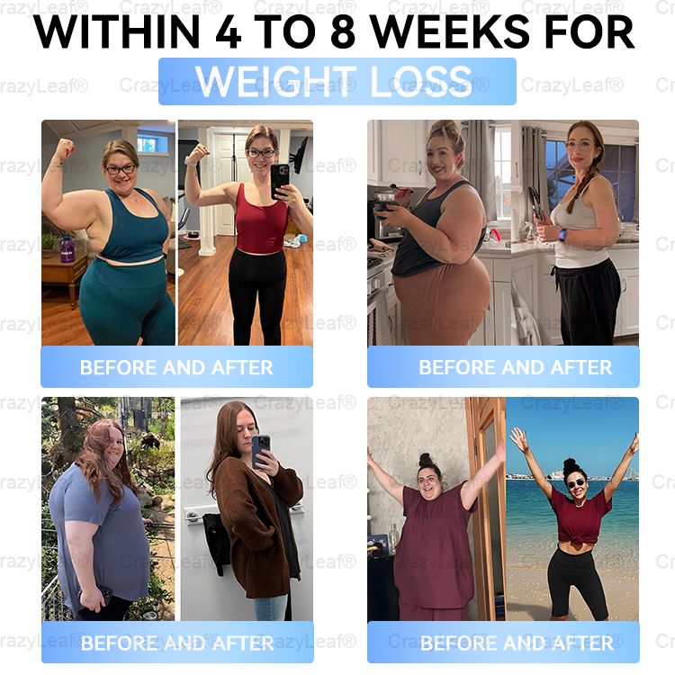 Clinically Proven| Official Store | Buildleaf® Tirzepatide Slimming & Health Nano Microneedle Patch with Collagen & Matrixyl 3000丨Targets Obesity, Loose Skin, High Blood Pressure, Diabetes, Fatty Liver, Joint Pain, Brain Fog, Low Energy and More